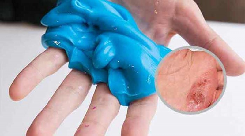Los peligros del slime, la masa elstica de moda entre chicos